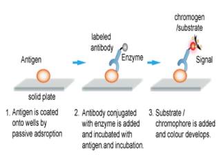 1. ELISA (ppt).pptx ENZYME LINKED IMMUNOSORBENT ESSAY | PPTX