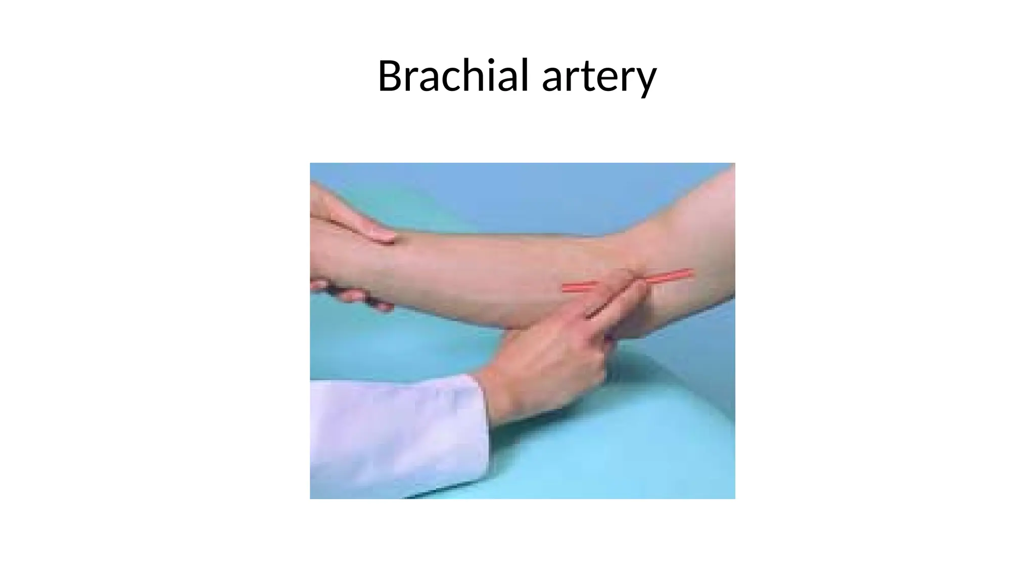 Brachial artery
 