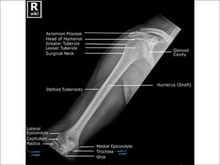 1.2 Upper Limb.pdf anatomy of the upper limb | PPT