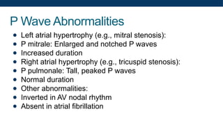 P Wave Abnormalities
● Left atrial hypertrophy (e.g., mitral stenosis):
● P mitrale: Enlarged and notched P waves
● Increased duration
● Right atrial hypertrophy (e.g., tricuspid stenosis):
● P pulmonale: Tall, peaked P waves
● Normal duration
● Other abnormalities:
● Inverted in AV nodal rhythm
● Absent in atrial fibrillation
 
