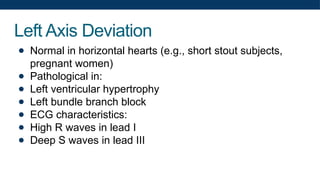 Left Axis Deviation
● Normal in horizontal hearts (e.g., short stout subjects,
pregnant women)
● Pathological in:
● Left ventricular hypertrophy
● Left bundle branch block
● ECG characteristics:
● High R waves in lead I
● Deep S waves in lead III
 
