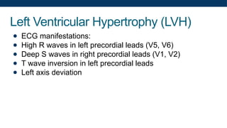 Left Ventricular Hypertrophy (LVH)
● ECG manifestations:
● High R waves in left precordial leads (V5, V6)
● Deep S waves in right precordial leads (V1, V2)
● T wave inversion in left precordial leads
● Left axis deviation
 
