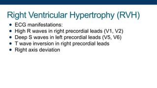 Right Ventricular Hypertrophy (RVH)
● ECG manifestations:
● High R waves in right precordial leads (V1, V2)
● Deep S waves in left precordial leads (V5, V6)
● T wave inversion in right precordial leads
● Right axis deviation
 
