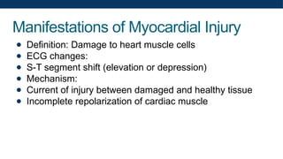 Manifestations of Myocardial Injury
● Definition: Damage to heart muscle cells
● ECG changes:
● S-T segment shift (elevation or depression)
● Mechanism:
● Current of injury between damaged and healthy tissue
● Incomplete repolarization of cardiac muscle
 