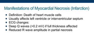 Manifestations of Myocardial Necrosis (Infarction)
● Definition: Death of heart muscle cells
● Usually affects left ventricle or interventricular septum
● ECG changes:
● Deep Q waves (>0.2 mV) if full thickness affected
● Reduced R wave amplitude in partial necrosis
 