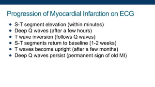 Progression of Myocardial Infarction on ECG
● S-T segment elevation (within minutes)
● Deep Q waves (after a few hours)
● T wave inversion (follows Q waves)
● S-T segments return to baseline (1-2 weeks)
● T waves become upright (after a few months)
● Deep Q waves persist (permanent sign of old MI)
 
