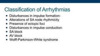 Classification of Arrhythmias
● Disturbances in impulse formation:
● Alterations of SA node rhythmicity
● Presence of ectopic foci
● Disturbances in impulse conduction:
● SA block
● AV block
● Wolff-Parkinson-White syndrome
 