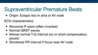 Supraventricular Premature Beats
● Origin: Ectopic foci in atria or AV node
ECG characteristics:
● Abnormal P wave (often inverted)
● Normal QRST waves
● Almost normal T-Q interval (no or short compensatory
pause)
● Shortened PR interval if focus near AV node
 