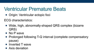 Ventricular Premature Beats
● Origin: Ventricular ectopic foci
ECG characteristics:
● Wide, high, abnormally-shaped QRS complex (bizarre
QRS)
● No P wave
● Prolonged following T-Q interval (complete compensatory
pause)
● Inverted T wave
● Axis deviation
 