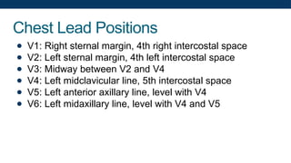 Chest Lead Positions
● V1: Right sternal margin, 4th right intercostal space
● V2: Left sternal margin, 4th left intercostal space
● V3: Midway between V2 and V4
● V4: Left midclavicular line, 5th intercostal space
● V5: Left anterior axillary line, level with V4
● V6: Left midaxillary line, level with V4 and V5
 
