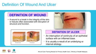 Wound Care Training Module for Primary Health Care | Ministry of Health Malaysia
Definition Of Wound And Ulcer
• A wound is a break in the integrity of the skin
or tissues often associated with disruption of
structure and function.
DEFINITION OF WOUND
DEFINITION OF ULCER
• An interruption of continuity of an epithelial
surface with an inflamed base.
• It is usually a result of an underlying or
internal etiology.
 