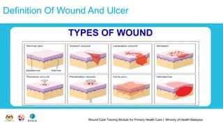 Wound Care Training Module for Primary Health Care | Ministry of Health Malaysia
Definition Of Wound And Ulcer
TYPES OF WOUND
 