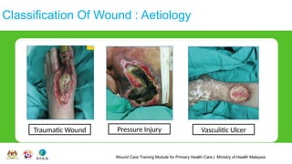 Wound Care Training Module for Primary Health Care | Ministry of Health Malaysia
Classification Of Wound : Aetiology
Traumatic Wound Pressure Injury Vasculitic Ulcer
 