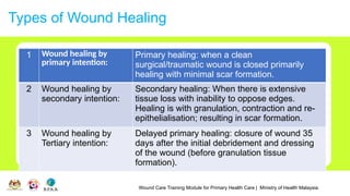 Wound Care Training Module for Primary Health Care | Ministry of Health Malaysia
Types of Wound Healing
1 Wound healing by
primary intention:
Primary healing: when a clean
surgical/traumatic wound is closed primarily
healing with minimal scar formation.
2 Wound healing by
secondary intention:
Secondary healing: When there is extensive
tissue loss with inability to oppose edges.
Healing is with granulation, contraction and re-
epithelialisation; resulting in scar formation.
3 Wound healing by
Tertiary intention:
Delayed primary healing: closure of wound 35
days after the initial debridement and dressing
of the wound (before granulation tissue
formation).
 