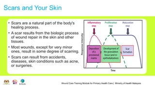 Wound Care Training Module for Primary Health Care | Ministry of Health Malaysia
Scars and Your Skin
• Scars are a natural part of the body's
healing process.
• A scar results from the biologic process
of wound repair in the skin and other
tissues.
• Most wounds, except for very minor
ones, result in some degree of scarring.
• Scars can result from accidents,
diseases, skin conditions such as acne,
or surgeries.
 