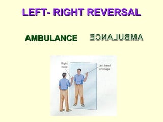 LEFT- RIGHT REVERSAL
LEFT- RIGHT REVERSAL
AMBULANCE
AMBULANCE
 