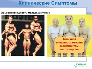 Клинические Симптомы
Типичная
внешность мужчин
с дефицитом
тестостерона
Обычная внешность молодых мужчин
 