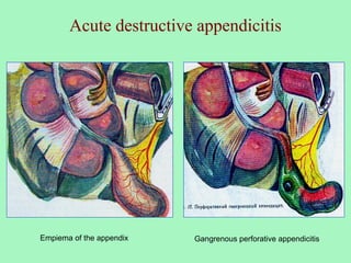 it is an inflammation of the vermiform appendix | PPT