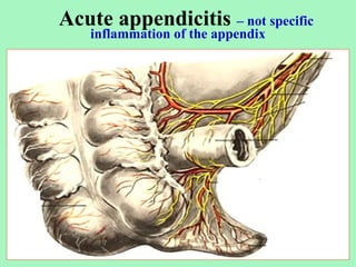 it is an inflammation of the vermiform appendix | PPT