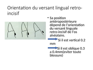 Orientation du versant lingual retro-
incisif
• Sa position
antéropostérieure
dépend de l’orientation
du versant linguale
retro-incisif de l’os
alvéolaire.
Si il est vertical 0.2
mm
Si il est oblique 0.3
a 0.4mm(eviter toute
blessure)
 