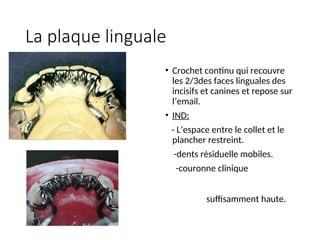 La plaque linguale
• Crochet continu qui recouvre
les 2/3des faces linguales des
incisifs et canines et repose sur
l’email.
• IND:
- L’espace entre le collet et le
plancher restreint.
-dents résiduelle mobiles.
-couronne clinique
suffisamment haute.
 