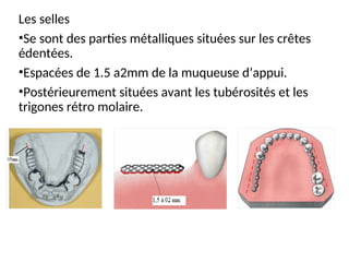 Les selles
•Se sont des parties métalliques situées sur les crêtes
édentées.
•Espacées de 1.5 a2mm de la muqueuse d’appui.
•Postérieurement situées avant les tubérosités et les
trigones rétro molaire.
 