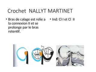Crochet NALLYT MARTINET
• Bras de calage est relie a
la connexion II et se
prolonge par le bras
retentif.
• Ind: Cl I et Cl II
 