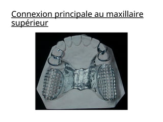 Connexion principale au maxillaire
supérieur
 