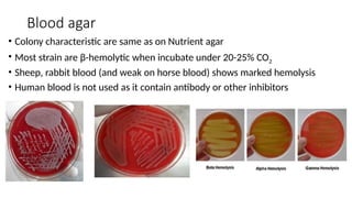 Blood agar
• Colony characteristic are same as on Nutrient agar
• Most strain are β-hemolytic when incubate under 20-25% CO2
• Sheep, rabbit blood (and weak on horse blood) shows marked hemolysis
• Human blood is not used as it contain antibody or other inhibitors
 