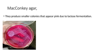 MacConkey agar,
• They produce smaller colonies that appear pink due to lactose fermentation.
 