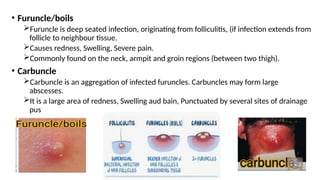 • Furuncle/boils
Furuncle is deep seated infection, originating from folliculitis, (if infection extends from
follicle to neighbour tissue.
Causes redness, Swelling, Severe pain.
Commonly found on the neck, armpit and groin regions (between two thigh).
• Carbuncle
Carbuncle is an aggregation of infected furuncles. Carbuncles may form large
abscesses.
It is a large area of redness, Swelling aud bain, Punctuated by several sites of drainage
pus
 