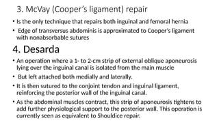 Mcvay Incision 1. Inguinal Hernia management by Yeshiwas.A.pptx