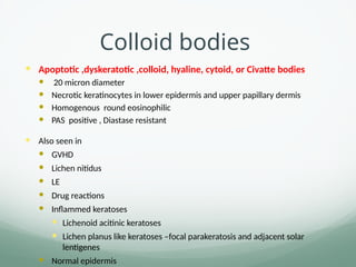 Colloid bodies
 Apoptotic ,dyskeratotic ,colloid, hyaline, cytoid, or Civatte bodies
 20 micron diameter
 Necrotic keratinocytes in lower epidermis and upper papillary dermis
 Homogenous round eosinophilic
 PAS positive , Diastase resistant
 Also seen in
 GVHD
 Lichen nitidus
 LE
 Drug reactions
 Inflammed keratoses
 Lichenoid acitinic keratoses
 Lichen planus like keratoses –focal parakeratosis and adjacent solar
lentigenes
 Normal epidermis
 