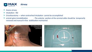 Airway
Assess airway
Intubation - RSI
Cricothyrotomy — when orotracheal intubation cannot be accomplished
ervical spine immobilization - The anterior portion of the cervical collar should be temporarily
removed and manual in-line stabilization maintained
 