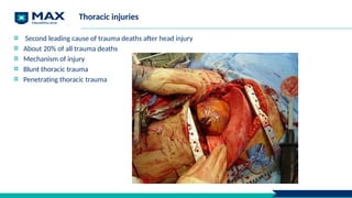Thoracic injuries
Second leading cause of trauma deaths after head injury
About 20% of all trauma deaths
Mechanism of injury
Blunt thoracic trauma
Penetrating thoracic trauma
 