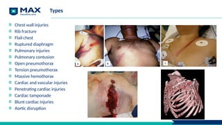 Types
Chest wall injuries
Rib fracture
Flail chest
Ruptured diaphragm
Pulmonary injuries
Pulmonary contusion
Open pneumothorax
Tension pneumothorax
Massive hemothorax
Cardiac and vascular injuries
Penetrating cardiac injuries
Cardiac tamponade
Blunt cardiac injuries
Aortic disruption
18
 