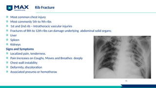 Rib Fracture
Most common chest injury
Most commonly 5th to 9th ribs
1st and 2nd rib – Intrathoracic vascular injuries
Fractures of 8th to 12th ribs can damage underlying abdominal solid organs:
Liver
Spleen
Kidneys
Signs and Symptoms
Localized pain, tenderness.
Pain Increases on Coughs, Moves and Breathes deeply
Chest wall instability
Deformity, discoloration
Associated pneumo or hemothorax
19
 