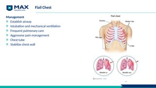Flail Chest
Management
Establish airway
Intubation and mechanical ventilation
Frequent pulmonary care
Aggressive pain management
Chest tube
Stabilize chest wall
22
 