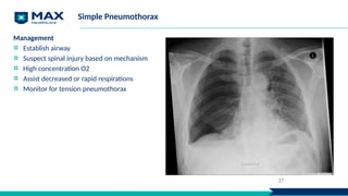 Simple Pneumothorax
Management
Establish airway
Suspect spinal injury based on mechanism
High concentration O2
Assist decreased or rapid respirations
Monitor for tension pneumothorax
27
 
