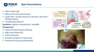 Open Pneumothorax
Hole in chest wall
Allows air to enter pleural space
Larger hole = Greater chance air will enter there than
through trachea
“Sucking Chest Wound”
Symptoms: Hypoxia, hemodynamic instability
Management:
Close hole with occlusive dressing
High concentration O2
Insert chest tube.
Consider transport on injured side
Monitor for tension pneumothorax
28
 