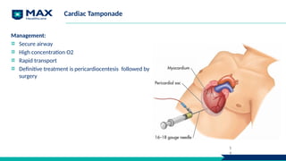 Cardiac Tamponade
Management:
Secure airway
High concentration O2
Rapid transport
Definitive treatment is pericardiocentesis followed by
surgery
5
4
 