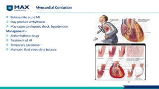 Myocardial Contusion
Behaves like acute MI
May produce arrhythmias
May cause cardiogenic shock, hypotension
Management –
Antiarrhythmic drugs
Treatment of HF
Temporary pacemaker
Maintain fluid electrolyte balance
38
 