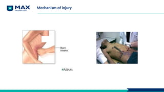 Mechanism of injury
 