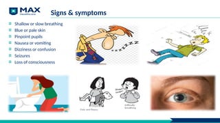 Signs & symptoms
Shallow or slow breathing
Blue or pale skin
Pinpoint pupils
Nausea or vomiting
Dizziness or confusion
Seizures
Loss of consciousness
 