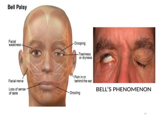 head and neck, head and neck head and neck | PPTX