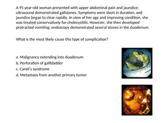 Caroli Types 1. Gall bladder and Biliary Disease (3).ppt