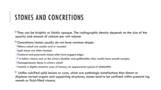 Pathologic Stones 1. Radiographs in Abdomen.approach to pain abdomen | PPTX