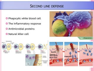  Phagocytic white blood cell
 The inflammatory response
 Antimicrobial proteins
 Natural killer cell
SECOND LINE DEFENSE
 