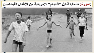 :‫صورة‬
‫الفيتناميين‬ ‫األطفال‬ ‫من‬ ‫األمريكية‬ "‫"النابالم‬ ‫قنابل‬ ‫ضحايا‬ :
 
