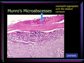 1. Histology of normal skin and Inflammatory cells- MG.pdf